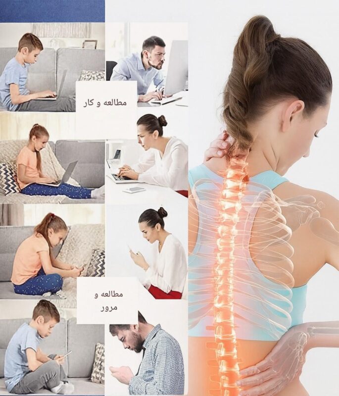 علائمی که نشان می‌دهد به قوزبند نیاز داریم